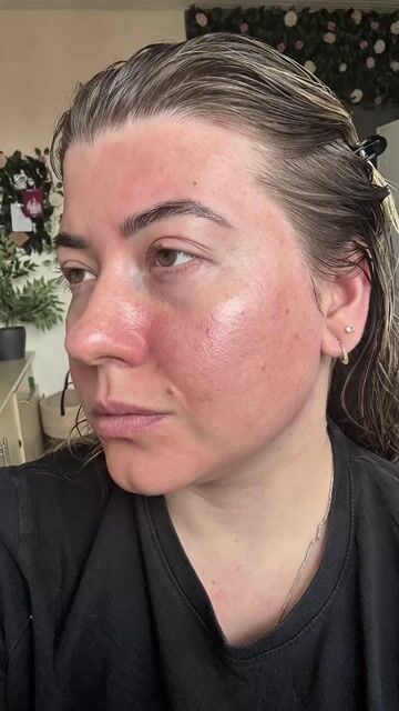 Skincare Storytelling · PT