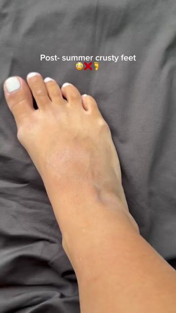 Foot care
